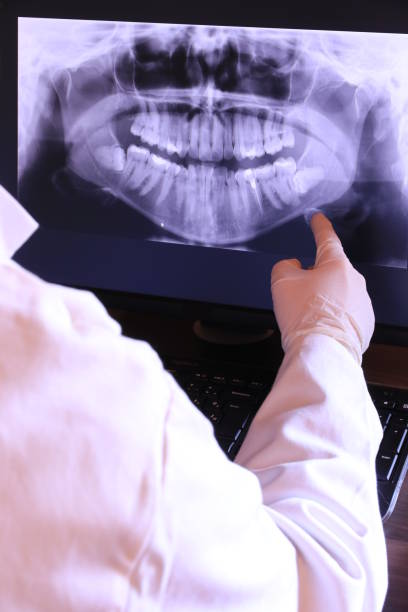 Best Emergency Dental Care for Broken or Chipped Teeth in Eastmont, WA