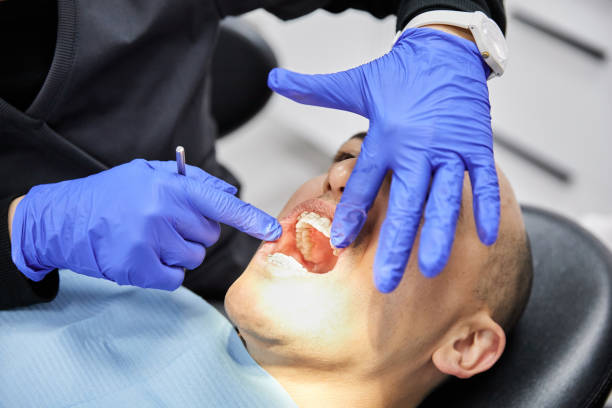 Best Emergency Gum Treatment in Eastmont, WA